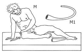 Dessin en relief du livre tactile (avant) de la statue de Galata en train de mourir.